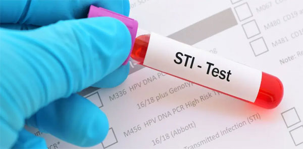 STD Testing and Screening